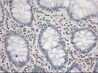 Anti-STAT3 antibody [21E7] used in IHC (Paraffin sections) (IHC-P). GTX83549