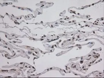 Anti-STAT3 antibody [21E7] used in IHC (Paraffin sections) (IHC-P). GTX83549