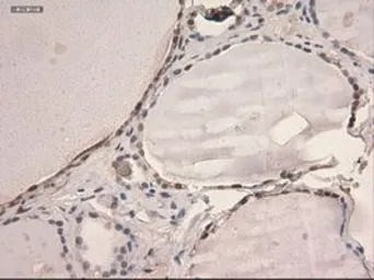 Anti-STAT3 antibody [21E7] used in IHC (Paraffin sections) (IHC-P). GTX83549