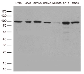 Anti-STAT3 antibody [21E7] used in Western Blot (WB). GTX83549
