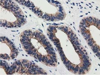 Anti-SSSCA1 antibody [2F5] used in IHC (Paraffin sections) (IHC-P). GTX83556