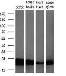 Anti-SSSCA1 antibody [2F5] used in Western Blot (WB). GTX83556