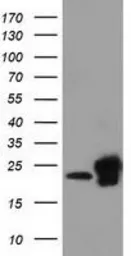 Anti-SSSCA1 antibody [2F5] used in Western Blot (WB). GTX83556