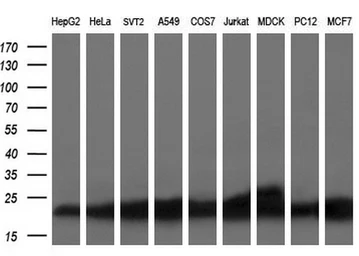 Anti-SSSCA1 antibody [2F5] used in Western Blot (WB). GTX83556