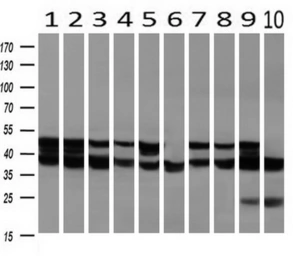 Anti-SSB antibody [1E11] used in Western Blot (WB). GTX83558