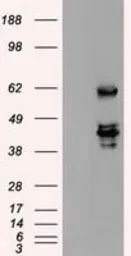 Anti-SSB antibody [1E11] used in Western Blot (WB). GTX83558
