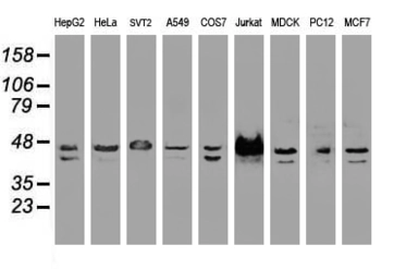 Anti-SSB antibody [1E11] used in Western Blot (WB). GTX83558