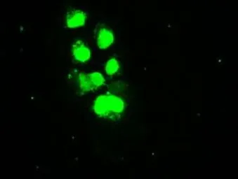 Anti-SSB antibody [1E11] used in Immunocytochemistry/ Immunofluorescence (ICC/IF). GTX83558