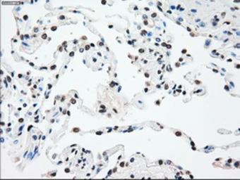 Anti-SSB antibody [3H9] used in IHC (Paraffin sections) (IHC-P). GTX83560
