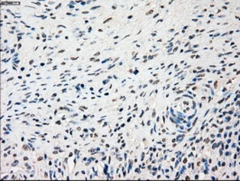 Anti-SSB antibody [3H9] used in IHC (Paraffin sections) (IHC-P). GTX83560