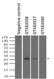 Anti-SSB antibody [3H9] used in Immunoprecipitation (IP). GTX83560