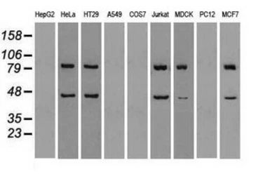 Anti-SSB antibody [3H9] used in Western Blot (WB). GTX83560