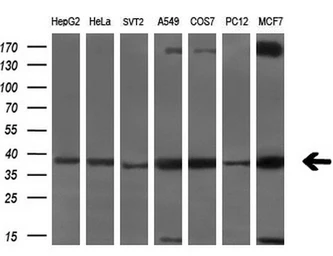 Anti-Serine racemase antibody [9E8] used in Western Blot (WB). GTX83567