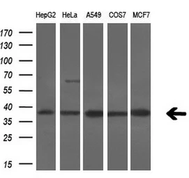 Anti-Serine racemase antibody [7E8] used in Western Blot (WB). GTX83568