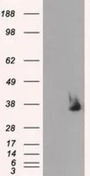 Anti-Serine racemase antibody [7E8] used in Western Blot (WB). GTX83568