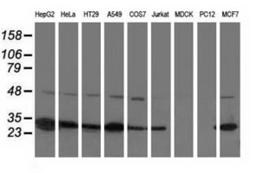 Anti-SPR antibody [1F4] used in Western Blot (WB). GTX83572