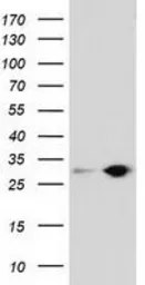 Anti-SPR antibody [3A9] used in Western Blot (WB). GTX83574