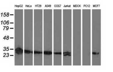 Anti-SPR antibody [3D6] used in Western Blot (WB). GTX83575