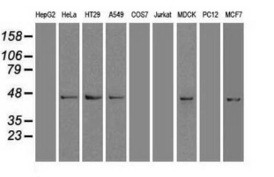 Anti-SOX17 antibody [3H5] used in Western Blot (WB). GTX83578