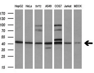 Anti-SOX17 antibody [3B10] used in Western Blot (WB). GTX83580