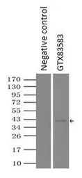 Anti-Sorbitol Dehydrogenase antibody [2A10] used in Immunoprecipitation (IP). GTX83583
