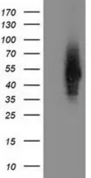 Anti-Syntrophin alpha 1 antibody [2B9] used in Western Blot (WB). GTX83606