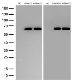 Anti-SMAD2 antibody [2C10] used in Western Blot (WB). GTX83612