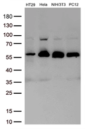 Anti-SMAD2 antibody [2C10] used in Western Blot (WB). GTX83612