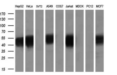 Anti-SMAD2 antibody [4G7] used in Western Blot (WB). GTX83613