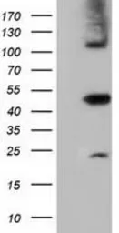 Anti-SLFNL1 antibody [4F7] used in Western Blot (WB). GTX83614