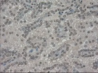 Anti-SLC7A8 antibody [8B12] used in IHC (Paraffin sections) (IHC-P). GTX83620