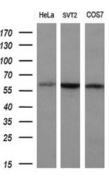 Anti-SLC7A8 antibody [8B12] used in Western Blot (WB). GTX83620