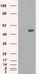 Anti-SLC7A8 antibody [8B12] used in Western Blot (WB). GTX83620