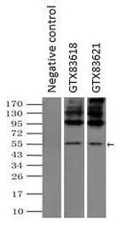 Anti-SLC7A8 antibody [4H10] used in Immunoprecipitation (IP). GTX83621