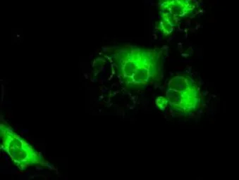 Anti-SLC7A8 antibody [4H10] used in Immunocytochemistry/ Immunofluorescence (ICC/IF). GTX83621