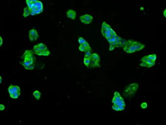Anti-SLC7A8 antibody [4H10] used in Immunocytochemistry/ Immunofluorescence (ICC/IF). GTX83621