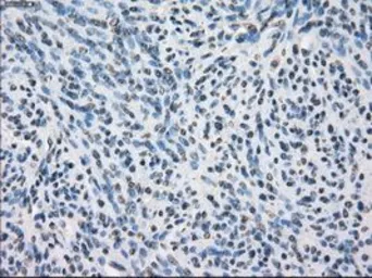 Anti-GluT6 antibody [7E3] used in IHC (Paraffin sections) (IHC-P). GTX83624