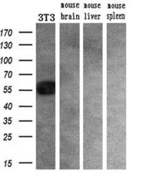 Anti-GluT6 antibody [7E3] used in Western Blot (WB). GTX83624