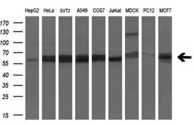 Anti-GluT6 antibody [7E3] used in Western Blot (WB). GTX83624