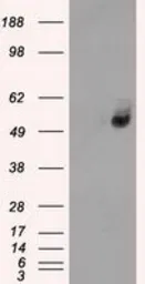Anti-GluT6 antibody [7E3] used in Western Blot (WB). GTX83624
