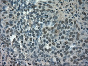 Anti-GLUT5 antibody [9F3] used in IHC (Paraffin sections) (IHC-P). GTX83628