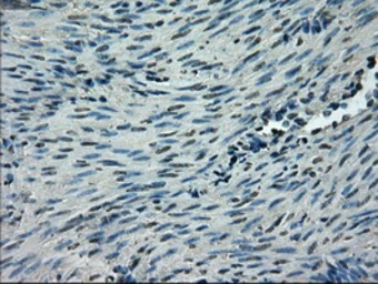 Anti-GLUT5 antibody [9F3] used in IHC (Paraffin sections) (IHC-P). GTX83628
