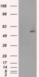 Anti-GLUT5 antibody [9F3] used in Western Blot (WB). GTX83628