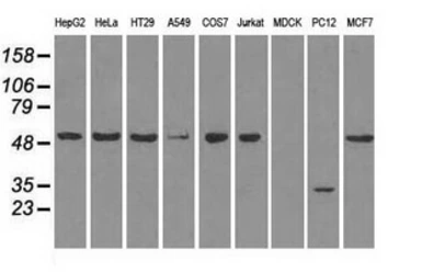 Anti-GLUT5 antibody [9F3] used in Western Blot (WB). GTX83628