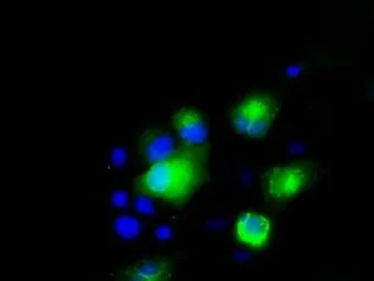 Anti-Melanoma gp100 antibody [7B2] used in Immunocytochemistry/ Immunofluorescence (ICC/IF). GTX83639