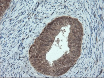 Anti-Melanoma gp100 antibody [8A4] used in IHC (Paraffin sections) (IHC-P). GTX83640
