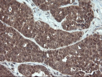 Anti-Melanoma gp100 antibody [8A4] used in IHC (Paraffin sections) (IHC-P). GTX83640