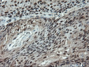 Anti-Melanoma gp100 antibody [8A4] used in IHC (Paraffin sections) (IHC-P). GTX83640