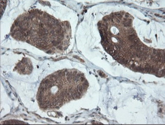 Anti-Melanoma gp100 antibody [8A4] used in IHC (Paraffin sections) (IHC-P). GTX83640