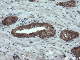 Anti-Melanoma gp100 antibody [8A4] used in IHC (Paraffin sections) (IHC-P). GTX83640